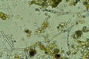 Pilze unter Microskop