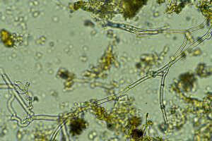 Pilze unter Microskop